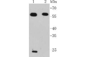 Lane 1: Jurkat, Lane 2: Raji lysates probed with IRF7 (2A1) Monoclonal Antibody  at 1:1000 overnight at 4˚C. (IRF7 抗体)
