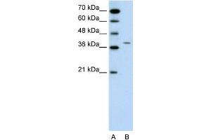 WB Suggested Anti-RAPSN Antibody Titration:  0. (RAPSN 抗体  (N-Term))