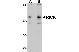 Western Blotting (WB) image for anti-Receptor-Interacting Serine-threonine Kinase 2 (RIPK2) (C-Term) antibody (ABIN1030619) (RIPK2 抗体  (C-Term))