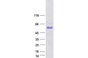 Western Blotting (WB) image for ABI Family, Member 3 (ABI3) (Transcript Variant 1) protein (Myc-DYKDDDDK Tag) (ABIN2714286)