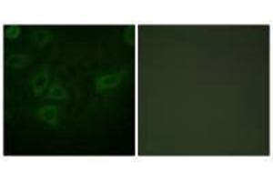 Immunofluorescence analysis of HepG2 cells, using TK (Ab-13) antibody. (TK1 抗体  (Ser13))