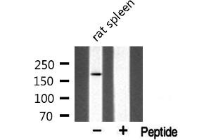 Western blot analysis of extracts from rat spleen, using MLH3 antibody. (MLH3 抗体  (Internal Region))