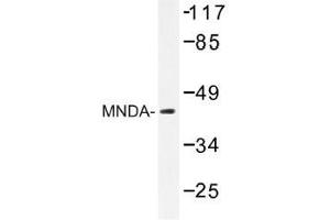 Image no. 1 for anti-Myeloid Cell Nuclear Differentiation Antigen (MNDA) antibody (ABIN317919) (MNDA 抗体)