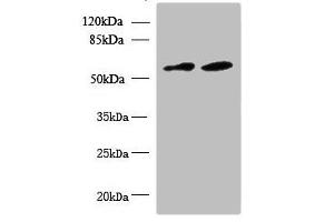 Western blot All lanes: KBTBD4 antibody at 10 μg/mL Lane 1: U87 whole cell lysate Lane 2: NIH/3T3 whole cell lysate Secondary Goat polyclonal to rabbit IgG at 1/10000 dilution Predicted band size: 59, 60 kDa Observed band size: 59 kDa (KBTBD4 抗体  (AA 151-415))