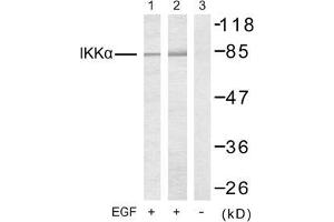 Image no. 2 for anti-conserved Helix-Loop-Helix Ubiquitous Kinase (CHUK) (Thr23) antibody (ABIN197306) (IKK alpha 抗体  (Thr23))