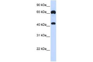 WB Suggested Anti-GUCY1B3 Antibody Titration:  0. (GUCY1B3 抗体  (N-Term))