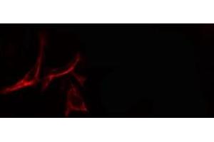 ABIN6278645 staining  COLO205 cells by IF/ICC. (TP53INP1 抗体  (Internal Region))