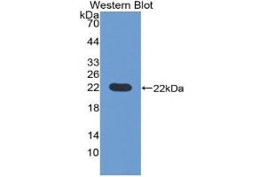 Western blot analysis of the recombinant protein. (Pronociceptin (AA 20-176) 抗体)