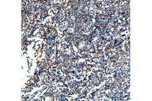 IHC analysis of VCAM1 using anti-VCAM1 antibody (ABIN5692810). (VCAM1 抗体  (AA 25-270))