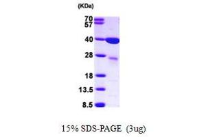 Lectin, Galactoside-Binding, Soluble, 8 (LGALS8) (AA 1-317) (Active) protein (His tag)
