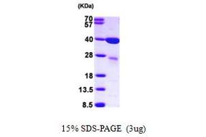 SDS-PAGE (SDS) image for Lectin, Galactoside-Binding, Soluble, 8 (LGALS8) (AA 1-317) protein (His tag) (ABIN667193) (LGALS8 Protein (AA 1-317) (His tag))