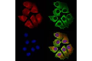 ABIN6263909 and ABIN6272972 staining Hela cells by IF/ICC. (OSBP 抗体  (Internal Region))