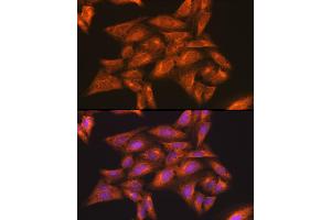 Immunofluorescence analysis of U-2 OS cells using IKKγ Rabbit pAb (ABIN3021150, ABIN3021151, ABIN3021152 and ABIN6214025) at dilution of 1:100 (40x lens). (IKBKG 抗体  (AA 1-419))