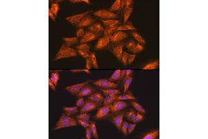 Immunofluorescence (IF) image for anti-Inhibitor of kappa Light Polypeptide Gene Enhancer in B-Cells, Kinase gamma (IKBKG) (AA 1-419) antibody (ABIN3021151)