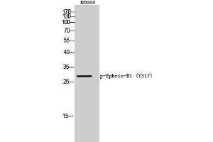 Western Blotting (WB) image for anti-Ephrin B1 (EFNB1) (pTyr317) antibody (ABIN3182253)
