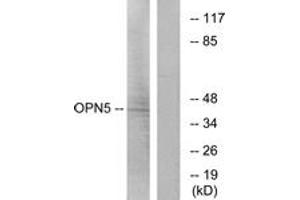 Western Blotting (WB) image for anti-Opsin 5 (OPN5) (AA 251-300) antibody (ABIN2890954) (OPN5 抗体  (AA 251-300))