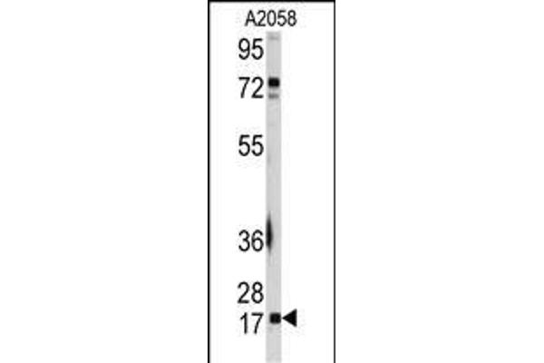 UBE2I Antikörper  (N-Term)