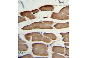 Formalin-fixed and paraffin-embedded human skeletal muscle with WNT5B Antibody (Center), which was peroxidase-conjugated to the secondary antibody, followed by DAB staining. (WNT5B 抗体  (AA 153-182))