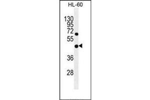 Western blot analysis of GDPD1 Antibody (N-term) in HL-60 cell line lysates (35ug/lane). (GDPD1 抗体  (N-Term))