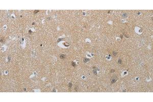 Immunohistochemistry of paraffin-embedded Human brain tissue using NPR1 Polyclonal Antibody at dilution of 1:30