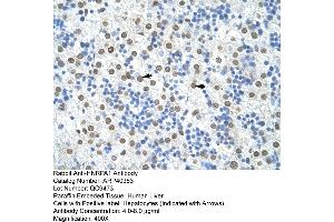 Rabbit Anti-HNRPA1 Antibody  Paraffin Embedded Tissue: Human Liver Cellular Data: Hepatocytes Antibody Concentration: 4. (HNRNPA1 抗体  (N-Term))