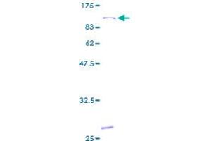 ALOX15 Protein (AA 1-662) (GST tag)