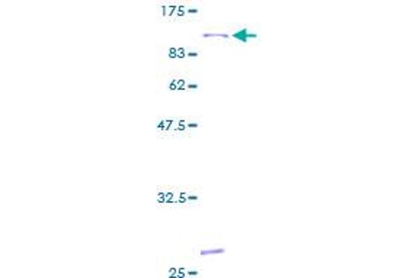 ALOX15 Protein (AA 1-662) (GST tag)