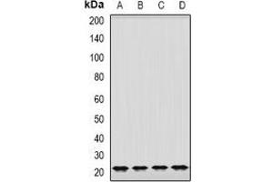 Western blot analysis of GrpEL2 expression in K562 (A), MCF7 (B), mouse brain (C), mouse lung (D) whole cell lysates. (GRPEL2 抗体)