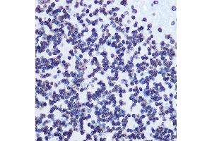 Immunohistochemistry of paraffin-embedded rat brain using Phospho-SMC1-S957 Rabbit mAb (ABIN7270613) at dilution of 1:100 (40x lens). (SMC1A 抗体  (pSer957))