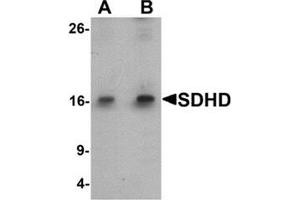 Western blot analysis of SDHD in EL4 cell lysate with SDHD antibody at (A) 1 and (B) 2 ug/mL. (SDHD 抗体  (Middle Region))
