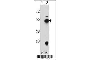 Western blot analysis of FDPS using rabbit polyclonal FDPS Antibody (D31) using 293 cell lysates (2 ug/lane) either nontransfected (Lane 1) or transiently transfected (Lane 2) with the FDPS gene.