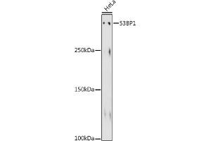 Western blot analysis of extracts of HeLa cells, using 53BP1 antibody (ABIN1679832, ABIN3018199, ABIN3018200 and ABIN7101582) at 1:500 dilution. (TP53BP1 抗体)