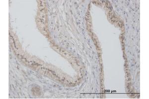 Immunoperoxidase of purified MaxPab antibody to FLOT2 on formalin-fixed paraffin-embedded human prostate. (Flotillin 2 抗体  (AA 1-379))