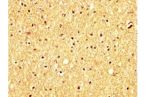 IHC image of ABIN7144013 diluted at 1:300 and staining in paraffin-embedded human brain tissue performed on a Leica BondTM system. (RHCG 抗体  (AA 416-479))