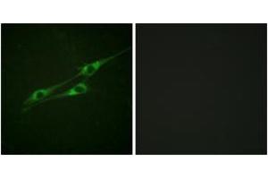 Immunofluorescence (IF) image for anti-Interleukin 13 Receptor, alpha 1 (IL13RA1) (AA 371-420) antibody (ABIN2888882) (IL13 Receptor alpha 1 抗体  (AA 371-420))