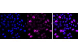 Immunocytochemical staining of HepG2 cells with Cyclin A2 antibody (ABIN7798186), 1:1,000). (Recombinant Cyclin A 抗体)