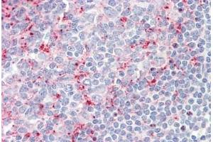 Human Tonsil: Formalin-Fixed, Paraffin-Embedded (FFPE)