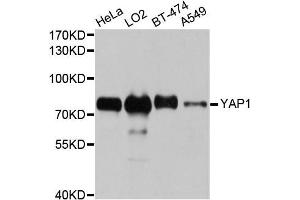 Western blot analysis of extracts of various cell lines, using YAP1 antibody. (YAP1 抗体)