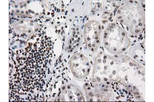 Immunohistochemical staining of paraffin-embedded Human Kidney tissue using anti-PRKCE mouse monoclonal antibody. (PKC epsilon 抗体)