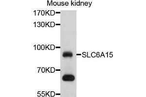Western blot analysis of extracts of mouse kidney, using SLC6A15 antibody (ABIN4905212) at 1:1000 dilution. (SLC6A15 抗体)