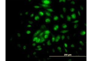Immunofluorescence of purified MaxPab antibody to RPA4 on HeLa cell. (RPA4 抗体  (AA 1-261))