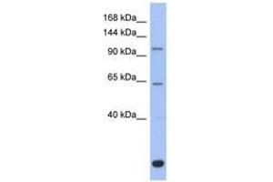 Image no. 1 for anti-BTB and CNC Homology 1, Basic Leucine Zipper Transcription Factor 2 (BACH2) (C-Term) antibody (ABIN6742357) (BACH2 抗体  (C-Term))