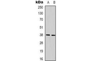 Western blot analysis of XRCC4 expression in Hela (A), 293T (B) whole cell lysates. (XRCC4 抗体)