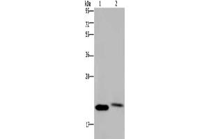 Gel: 10 % SDS-PAGE, Lysate: 40 μg, Lane 1-2: Human fetal brain tissue, Jurkat cells, Primary antibody: ABIN7191712(NRAS Antibody) at dilution 1/200, Secondary antibody: Goat anti rabbit IgG at 1/8000 dilution, Exposure time: 10 minutes (GTPase NRas 抗体)