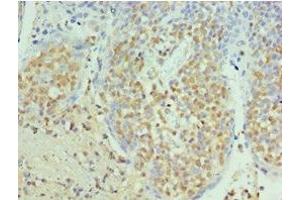 Immunohistochemistry of paraffin-embedded human tonsil tissue using ABIN7168869 at dilution of 1:100 (Septin 6 抗体  (AA 350-434))