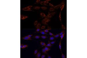Immunofluorescence analysis of C6 cells using PFDN4 antibody (ABIN7269508) at dilution of 1:100. (PFDN4 抗体  (AA 1-134))