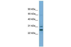 WB Suggested Anti-DHRS2  Antibody Titration: 0. (DHRS2 抗体  (N-Term))