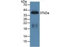 Detection of Recombinant PP, Mouse using Polyclonal Antibody to Pancreatic Polypeptide (PP) (PPY 抗体  (AA 31-97))
