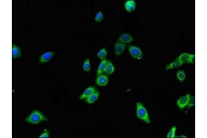 Immunofluorescent analysis of HepG2 cells using ABIN7167377 at dilution of 1:100 and Alexa Fluor 488-congugated AffiniPure Goat Anti-Rabbit IgG(H+L) (RAB7A 抗体  (AA 110-177))