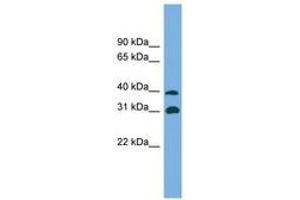 Image no. 1 for anti-Crystallin, mu (CRYM) (AA 179-228) antibody (ABIN6743608) (CRYM 抗体  (AA 179-228))